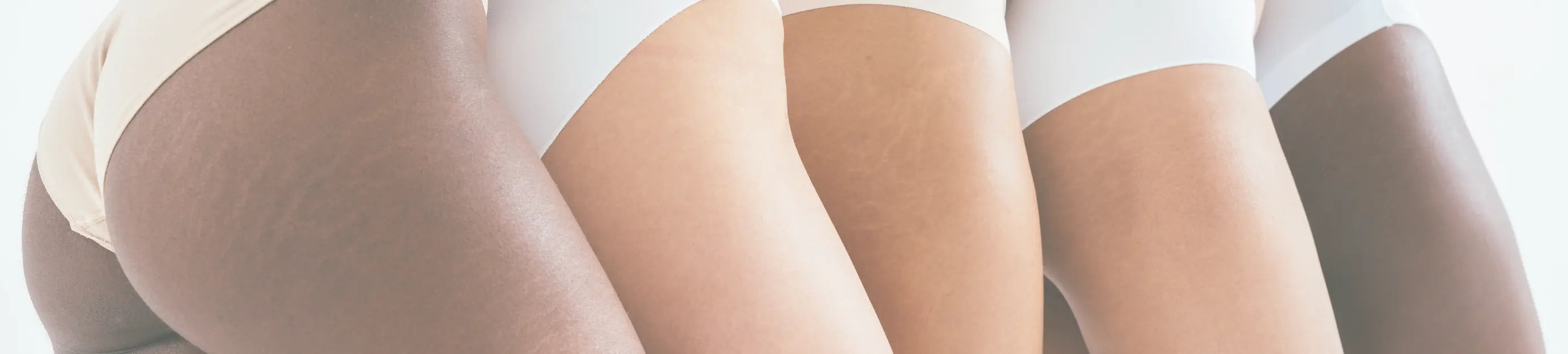 Body-Hyperpigmentation Bandari BeautyGreenhouse Mall Suit 25, Ngong Road, Kilimani, Nairobi Kenya