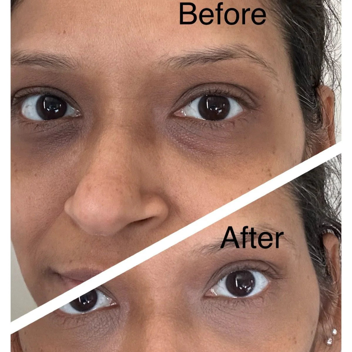 Dr Vanita Rattan Dark Circles Kit Dr VanitaGreenhouse Mall Suit 25, Ngong Road, Kilimani, Nairobi Kenya