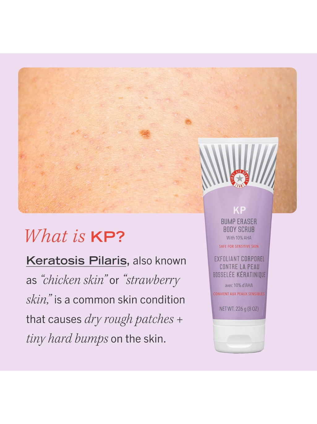 First Aid Beauty- KP Bump Eraser Body Scrub with 10% AHA-114g First Aid BeautyGreenhouse Mall Suit 25, Ngong Road, Kilimani, Nairobi Kenya