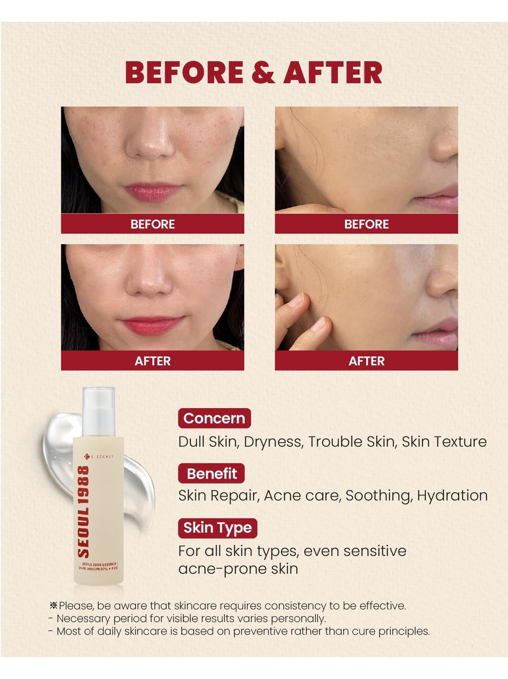 K-Secret Seoul 1988 Essence Snail Mucin 97% + Rice -100ml K-SECRETGreenhouse Mall Suit 25, Ngong Road, Kilimani, Nairobi Kenya