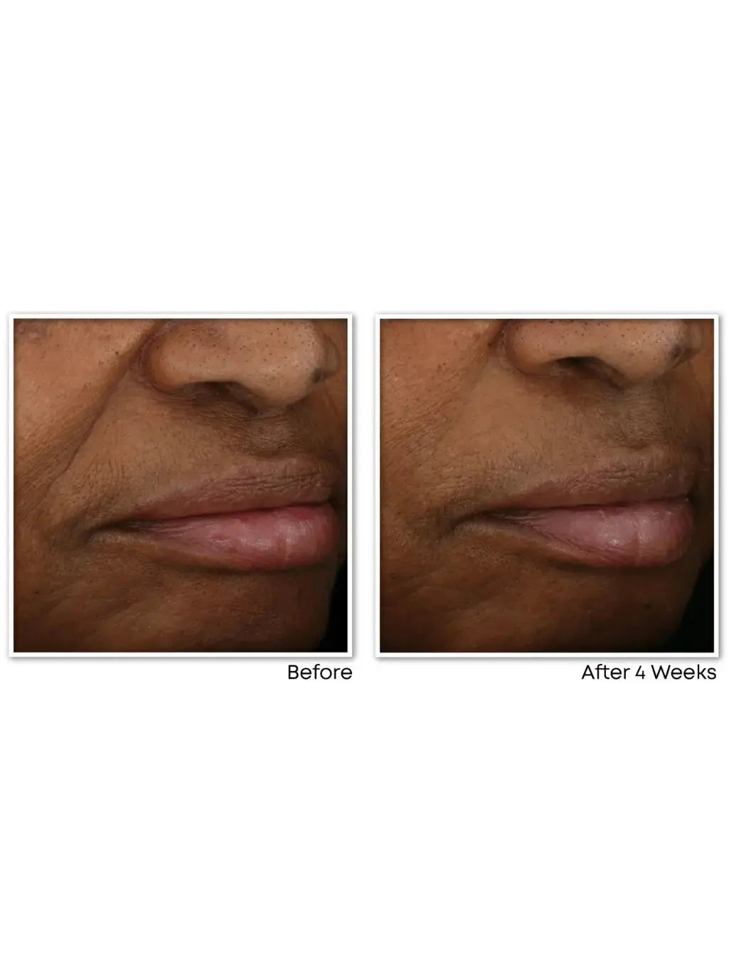 RoC Vitamin C Correxion Revive + Glow Moisturizer - 48g RocGreenhouse Mall Suit 25, Ngong Road, Nairobi Kenya